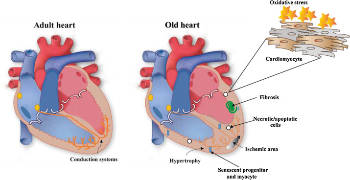 El corazón y el estrés oxidativo